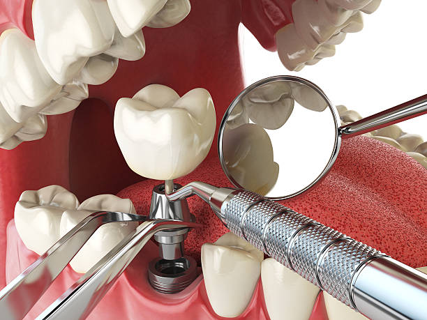 Best Emergency Dental Care for Broken or Chipped Teeth in Citrus City, TX
